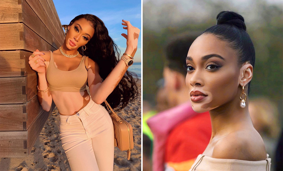 Winnie Harlow |:  8 supermodelos que cambiaron nuestra belleza |  Zestradar