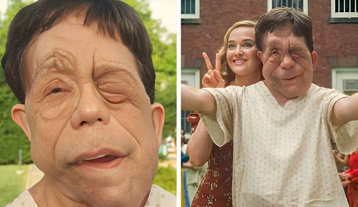 #4 |  Cómo Adam Pearson derritió los corazones de los fanáticos (y Scarlett Johansson)  Zestradar