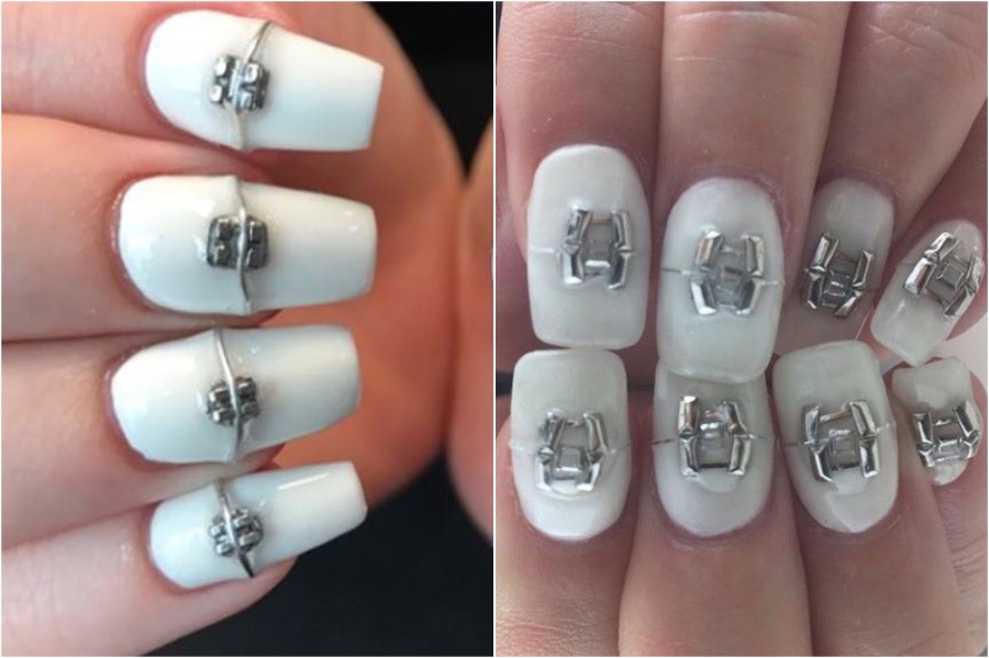 Brace Nail Art |:  Las tendencias de arte de uñas más locas |  Zestradar