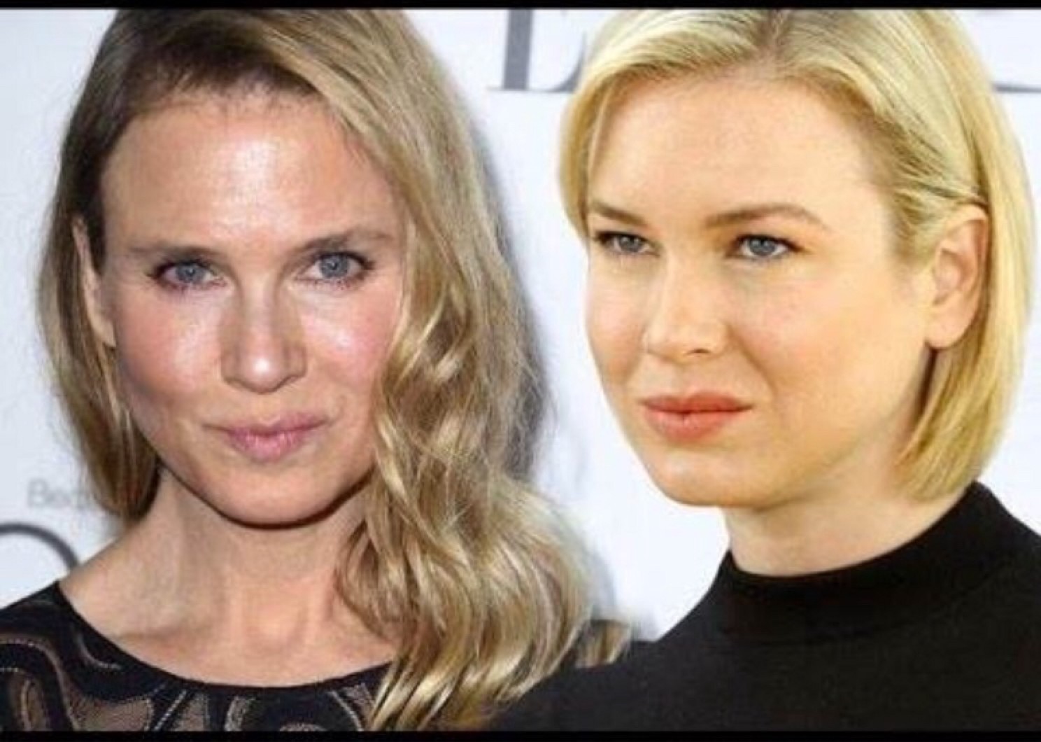 Fail-celebs-12-renee-zellweger